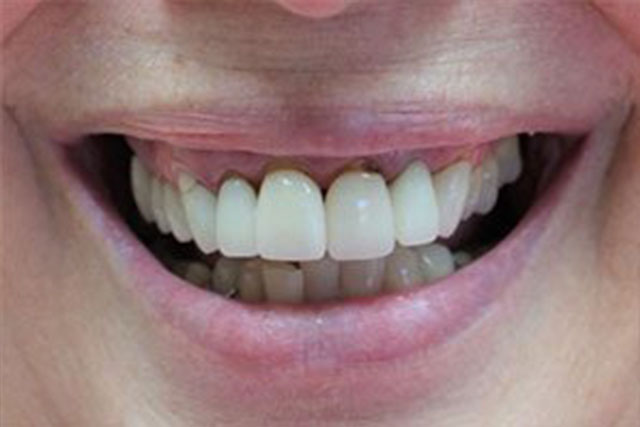 Dental Before
