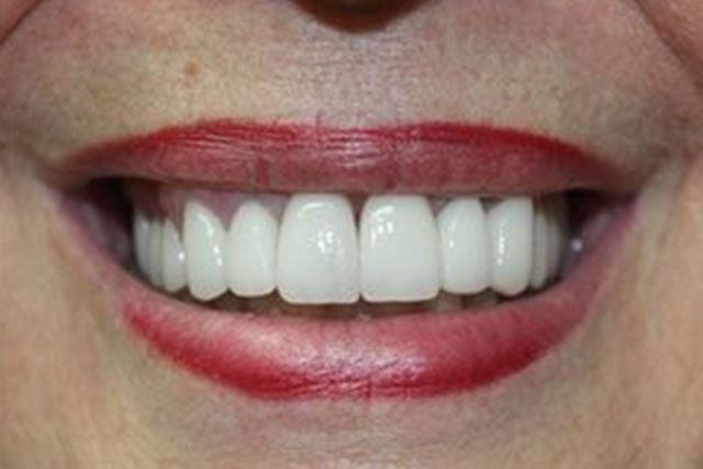 Dental After
